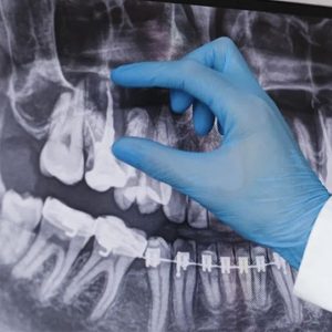 chuẩn đoán hình ảnh