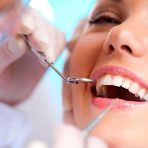 đặt lịch khám răng tổng quát tại booking heal