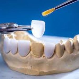 nha khoa thẩm mỹ phục hình răng