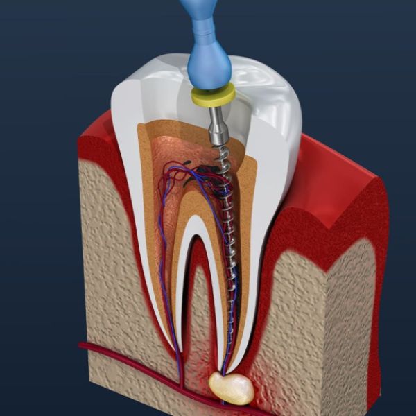 đặt lịch khám Nội khoa răng tặng booking heal