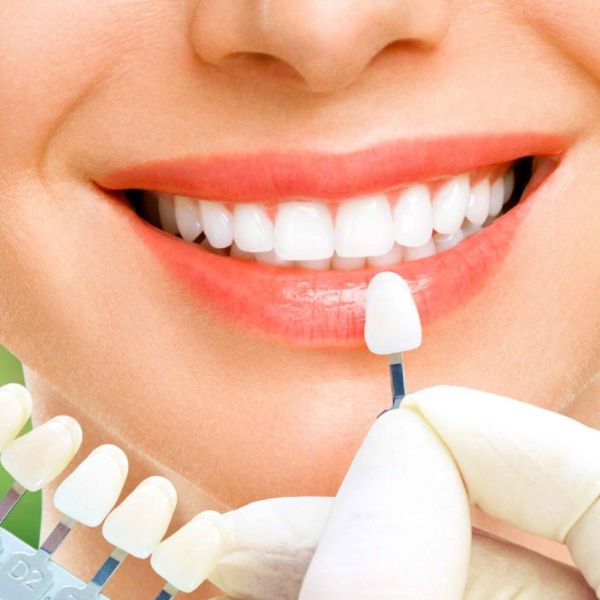 Đặt lịch thẩm mỹ răng tại booking heal