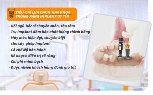 Xem kỹ các tiêu chí đánh giá để chọn được nha khoa implant uy tín TPHCM