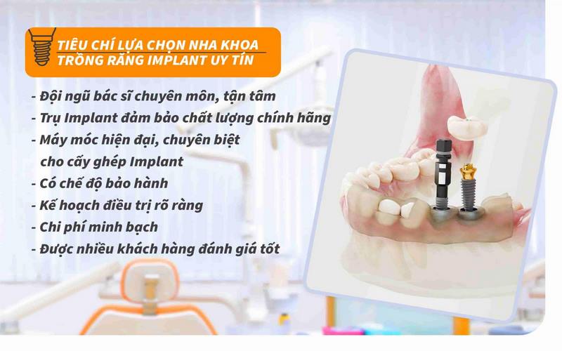 Xem kỹ các tiêu chí đánh giá để chọn được nha khoa implant uy tín TPHCM