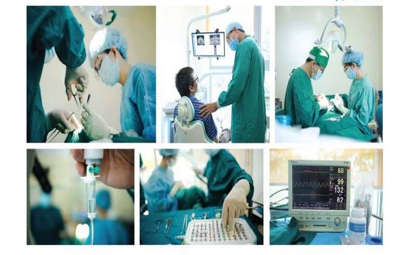Quy trình trồng răng hiện đại tại nha khoa Dr. Care