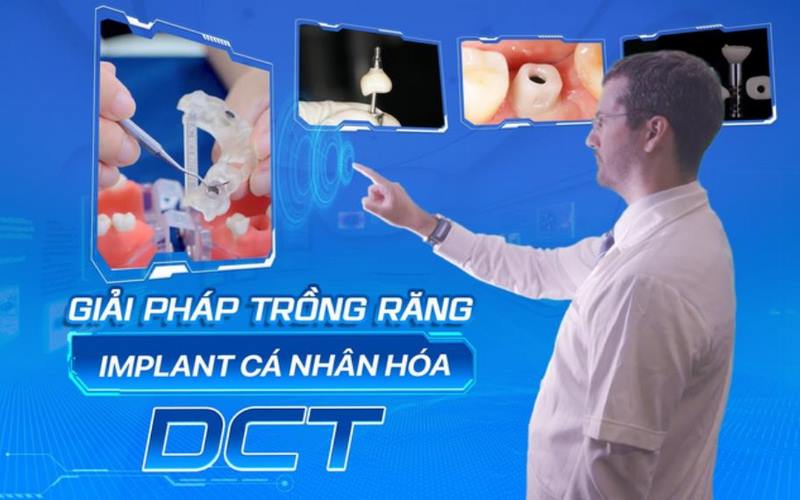 Phác đồ trồng răng implant cá nhân hóa DCT tại Lạc Việt Intech 