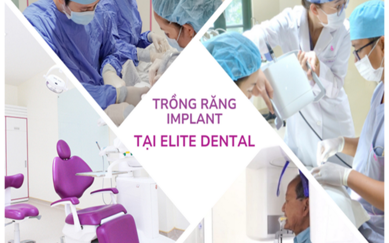Trồng răng implant an toàn, chất lượng tại nha khoa Elite