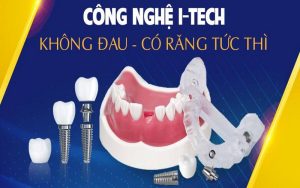 Công nghệ phục hình răng implant I-Tech tại nha khoa Việt Úc