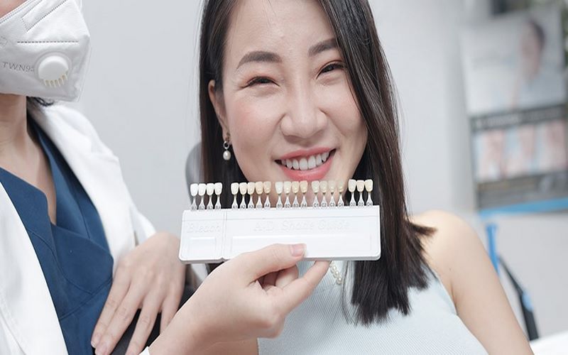 Làm răng sứ tại nha khoa Kim