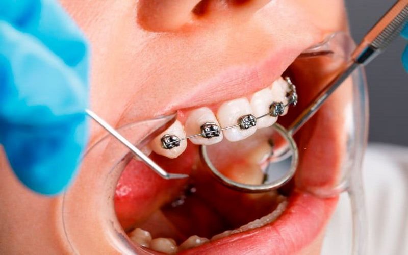 Bác sĩ niềng răng giàu kinh nghiệm tại nha khoa Dr.Vương