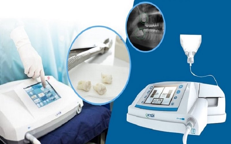 Fami Dental nhổ răng khôn bằng sóng siêu âm Piezotome 