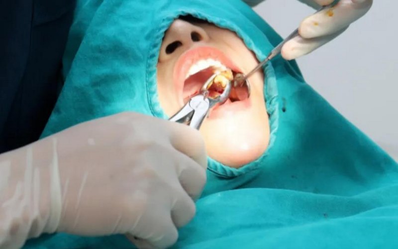 Khu tiểu phẫu răng khôn bệnh viện RHM TW
