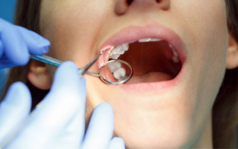 Nha khoa KIM sở hữu quy trình nhổ răng khôn hiện đại tại Hà Nội
