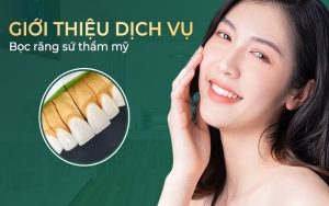 Dịch vụ bọc sứ đẳng cấp, độ bền cao tại nha khoa Asia