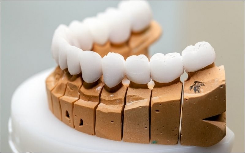 Đa dạng chất liệu sứ của thương hiệu nổi tiếng được sử dụng tại nha khoa Happy