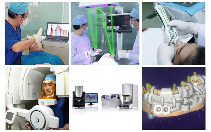 Trang thiết bị cấy ghép Implant hiện đại I-Dent