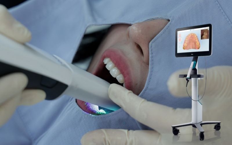 Kỹ thuật trồng răng bằng implant cao cấp tại nha khoa Trồng Răng Sài Gòn 