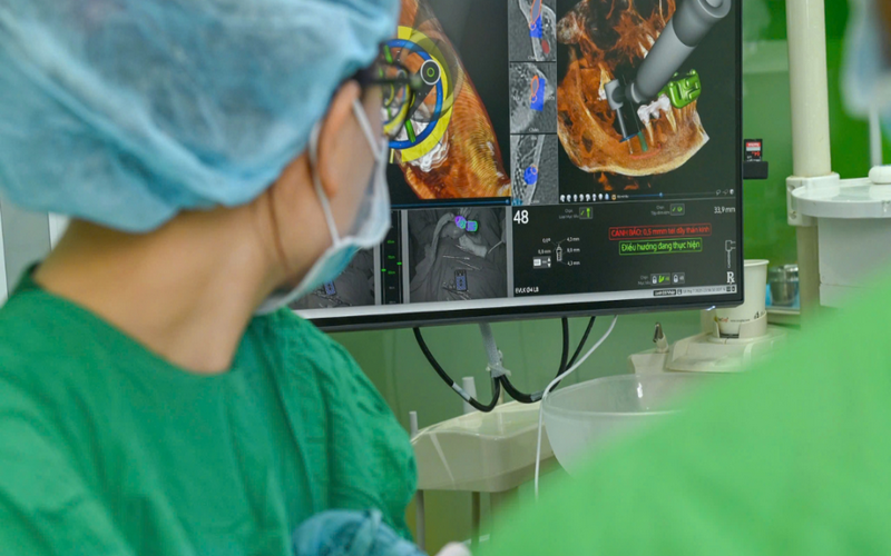 Công nghệ định vị 3D - X-Guide ứng dụng tại nha khoa Implant Đà Nẵng