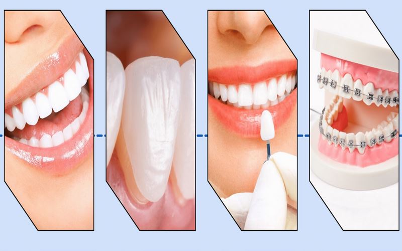 Đa dạng dịch vụ được cung cấp tại nha khoa Việt Anh